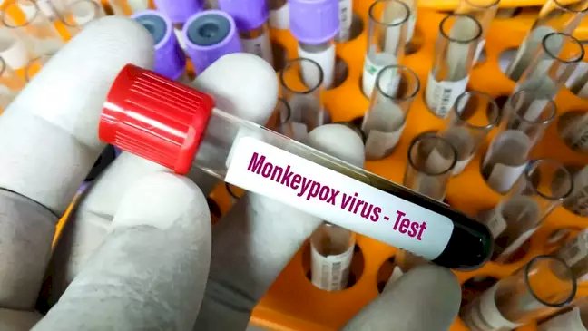 Sintomas da varíola dos macacos: 7 sinais que podem indicar a presença da doença