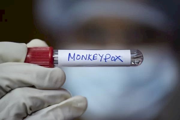 OMS oficializa mudança de nome da varíola dos macacos para mpox