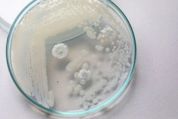 Candida auris: fungo que deixa EUA em alerta já causou surto no Brasil
